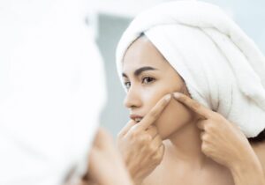 Why Acne During Pregnancy Is Common and How to Get Rid of It
